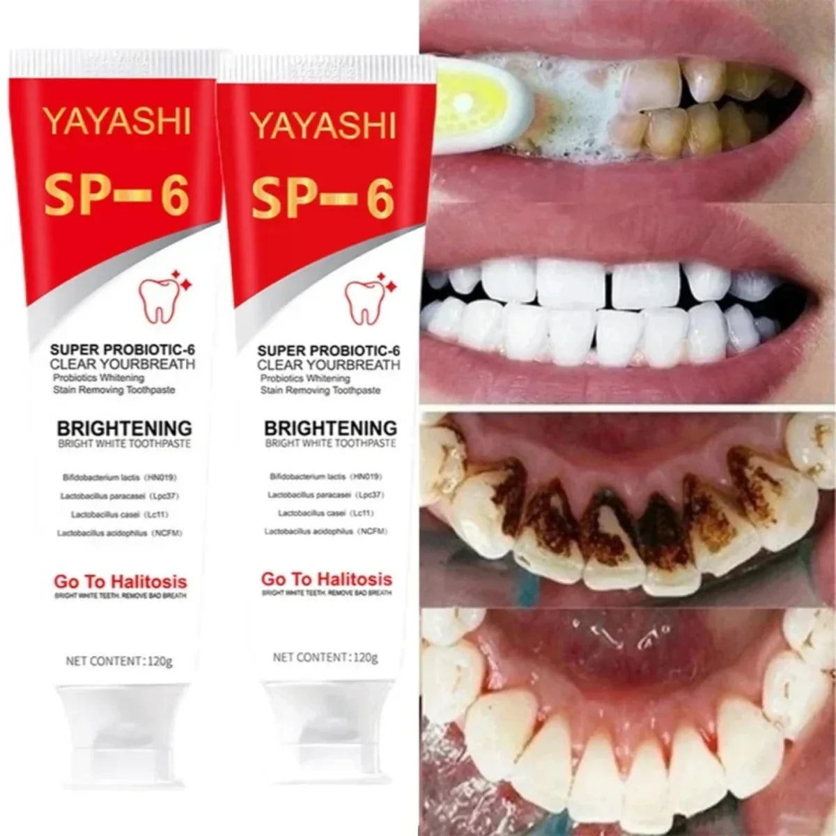 Teeth Whitening Paste SP-6