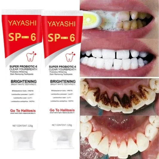 Teeth Whitening Paste SP-6